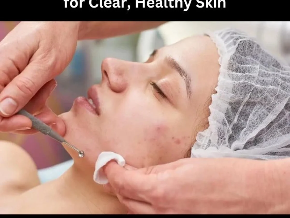 Acne Treatment