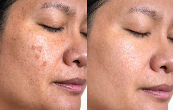 Before After (14)