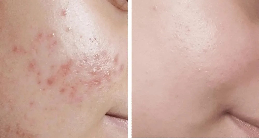Before After (16)