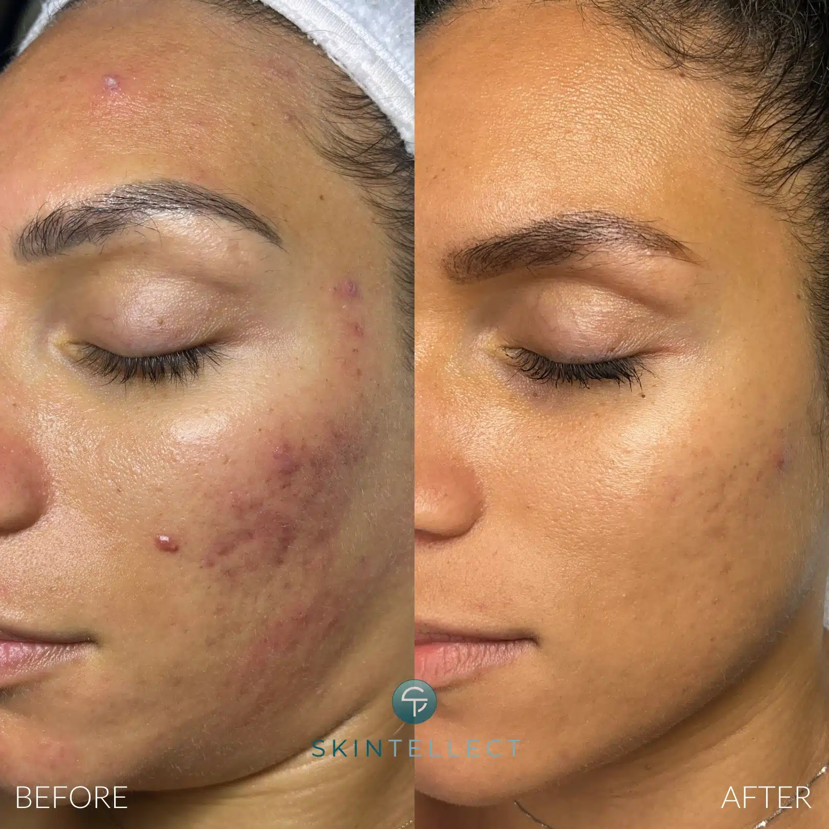 Before After (18)