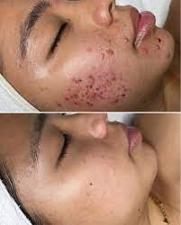 Before After (19)