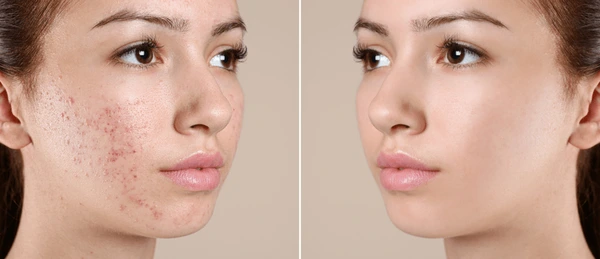 Before After (20)