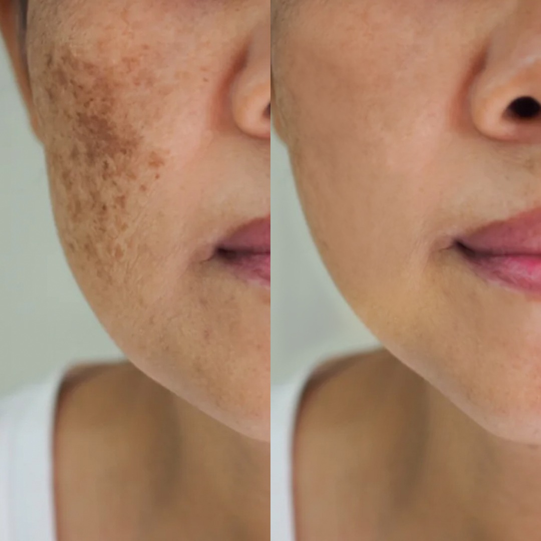 Before After (7)