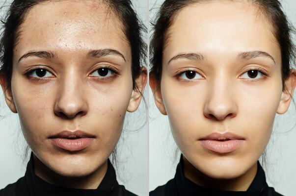 Before After (21)