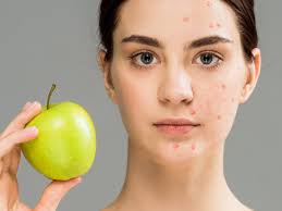 Diet & Skin Health